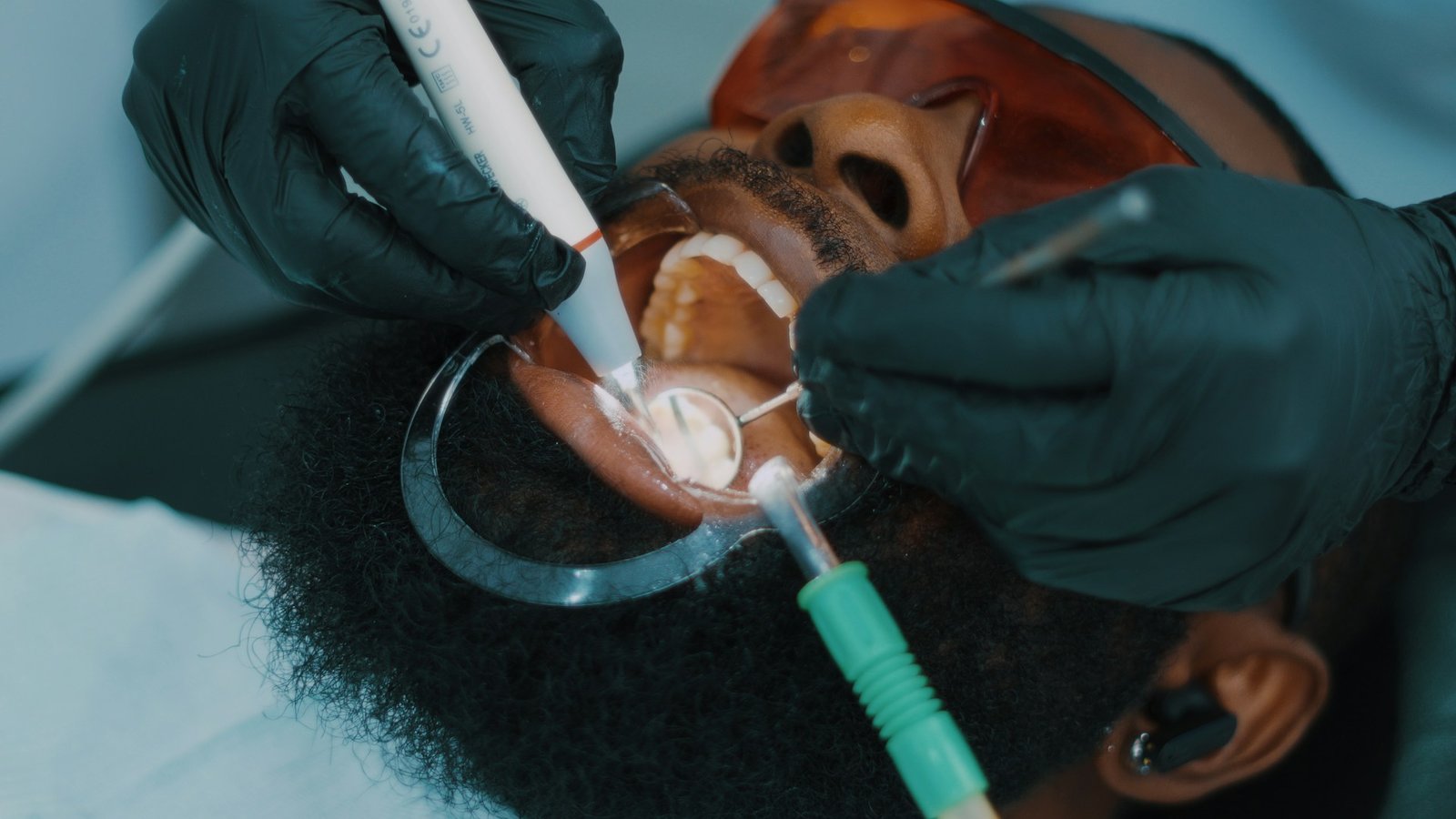 Dental Abscess Management