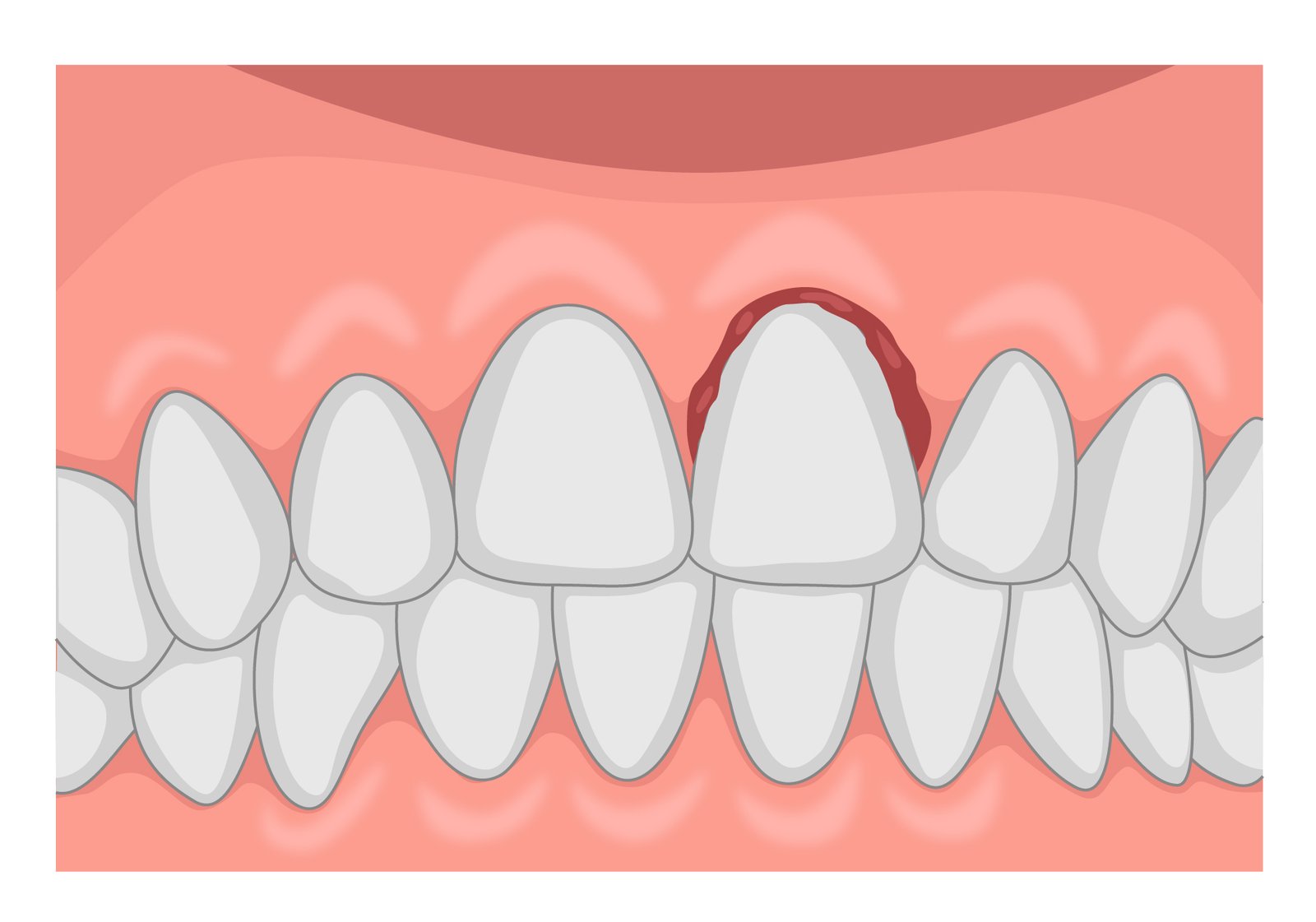 Dental Trauma Assessment
