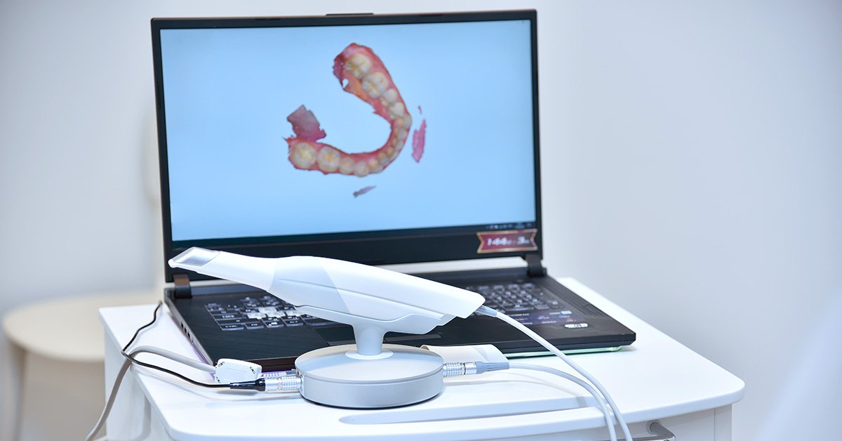 Digital Scanning