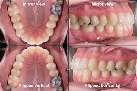 Intraoral Photography