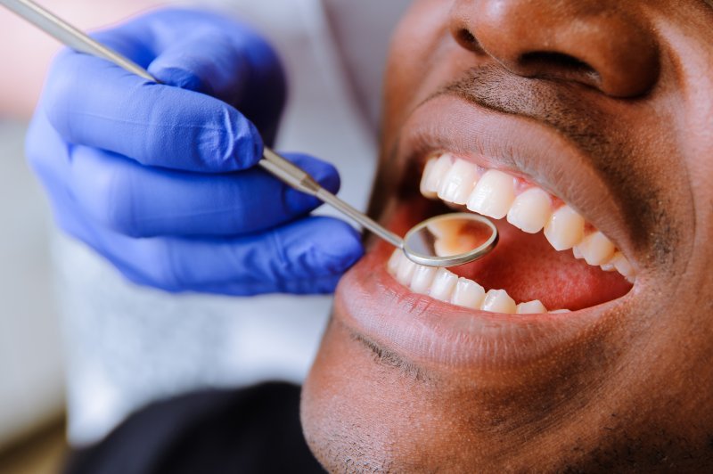 Oral Cancer Screening
