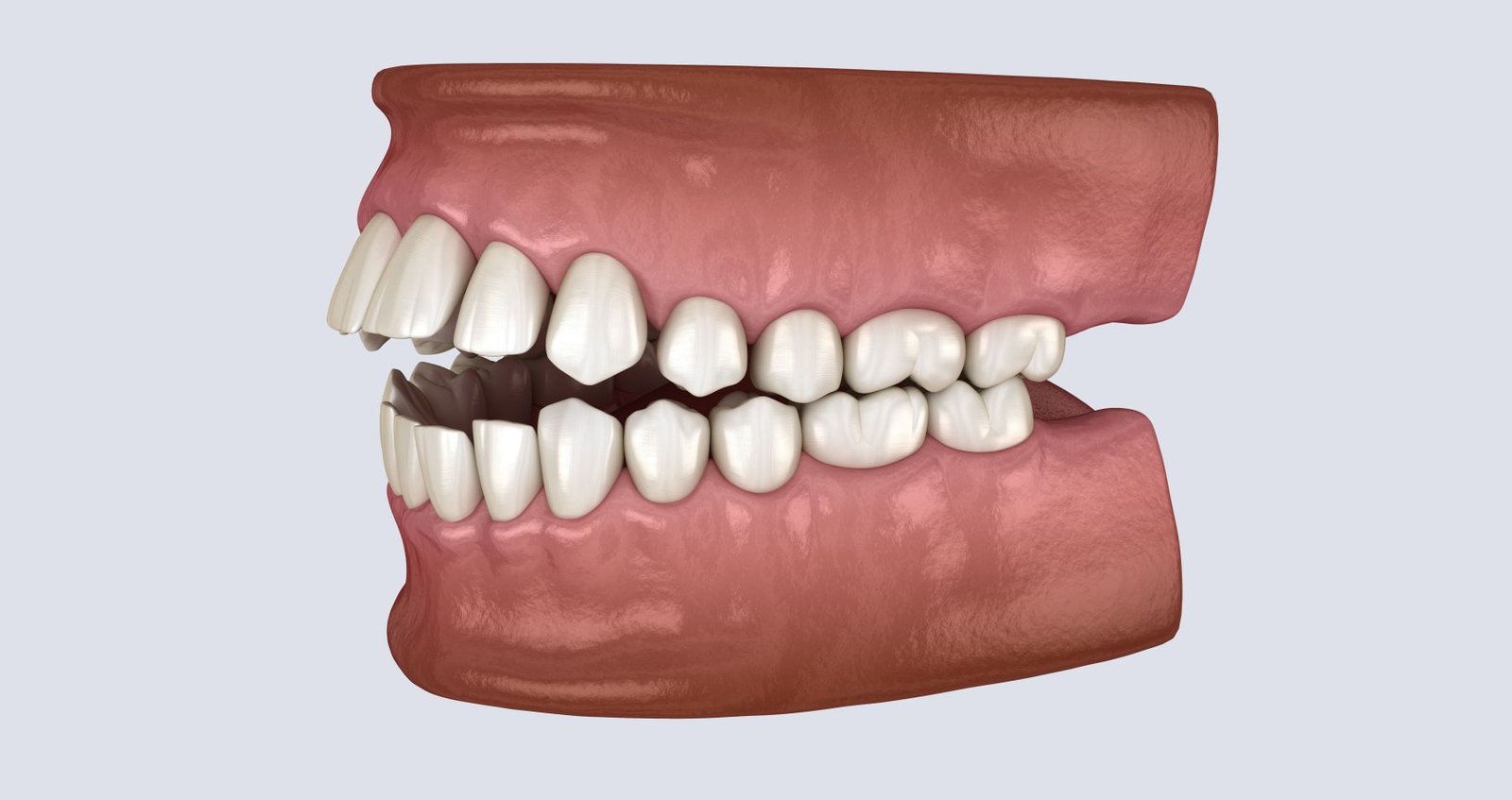Dentofacial Orthopedics