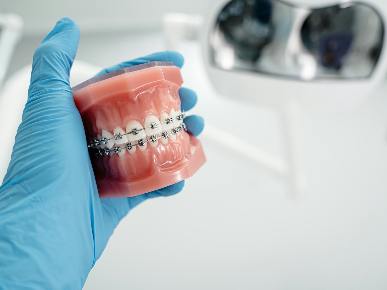 Metal Braces
