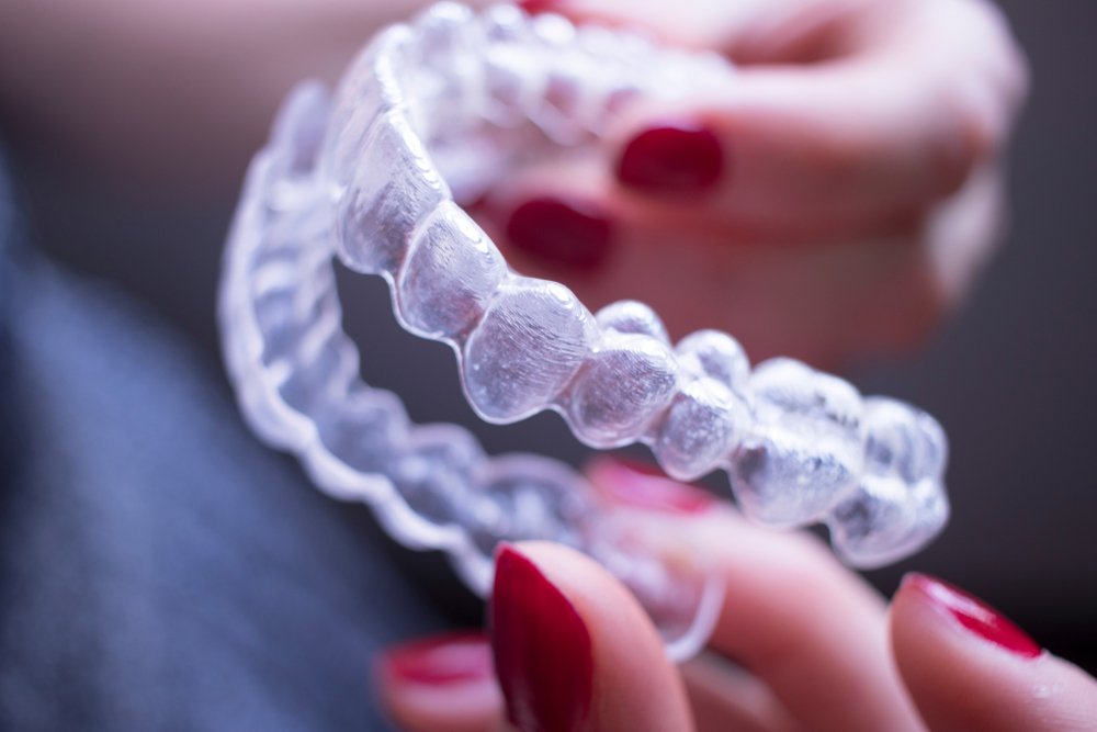 Retainer Replacement